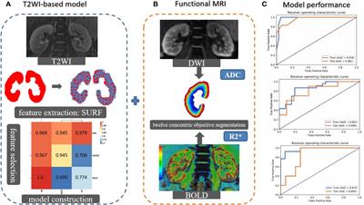 Machine learning-based multimodal MRI texture analysis for assessing renal function and fibrosis in diabetic nephropathy: a retrospective study